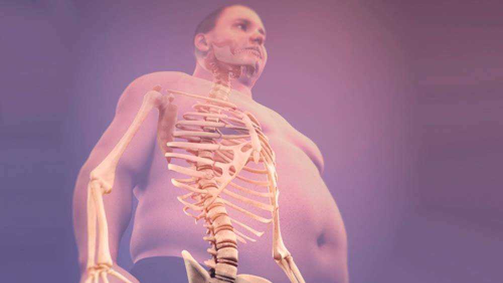 Широкая кость и ожирение: развенчиваем мифы. “у меня кость широкая”: что говорят ученые о плотности и весе костей когда девушка говорит кость широкая