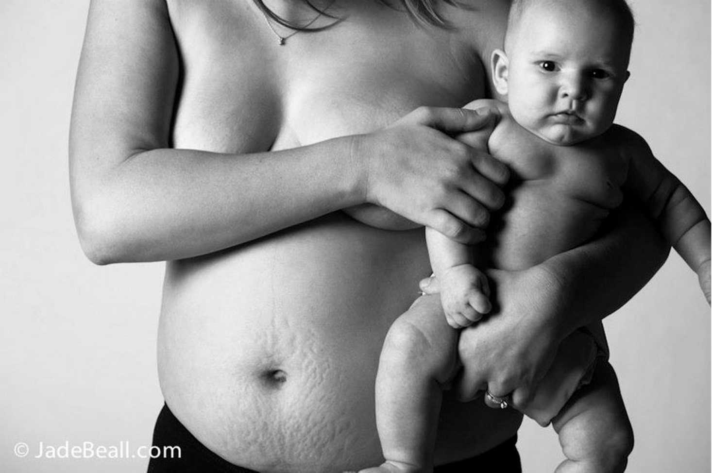 Естественные роды фото: 20 сильных фотографий родов, которые никого не оставят равнодушным – очень подробные фотографии процесса родов в роддоме