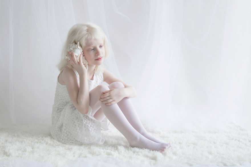 Дети-альбиносы: причины и симптомы заболевания
