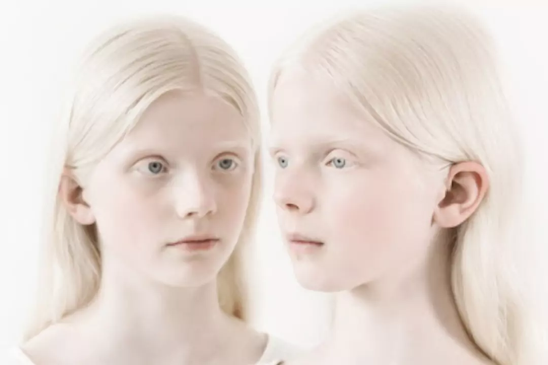 Люди с уникальной внешностью в фотопроекте albinos