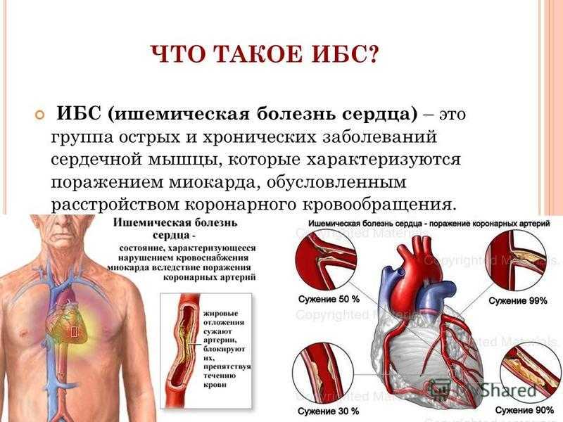 Факторы ишемии. Ишемическая болезнь сердца (ИБС). Клинические проявления ишемической болезни сердца. Ишемическая болезнь сердца поражение миокарда. Проявления ишемической болезни сердца хронической и острой.