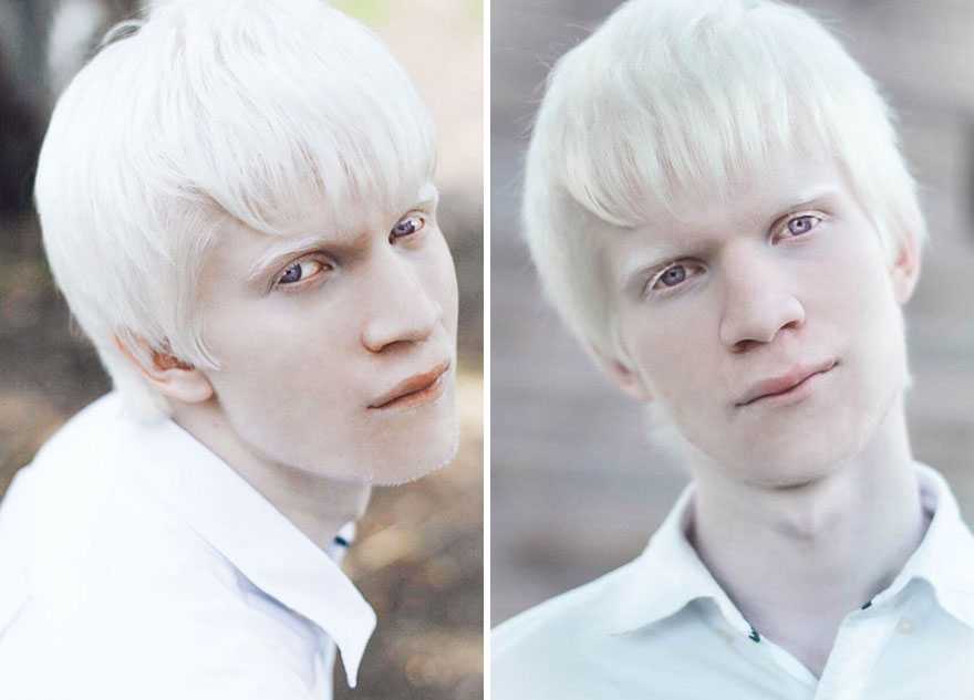 Люди альбиносы: факты, известные модели-альбиносы