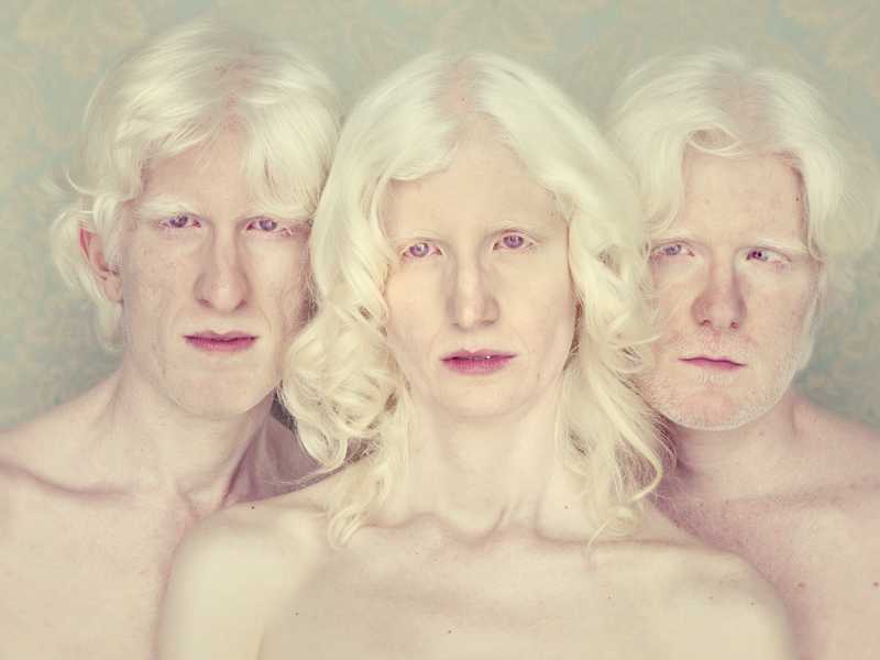 Топ-10 трагических фактов про людей-альбиносов в африке (+фото)