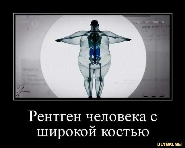 Почему мышц больше чем костей
